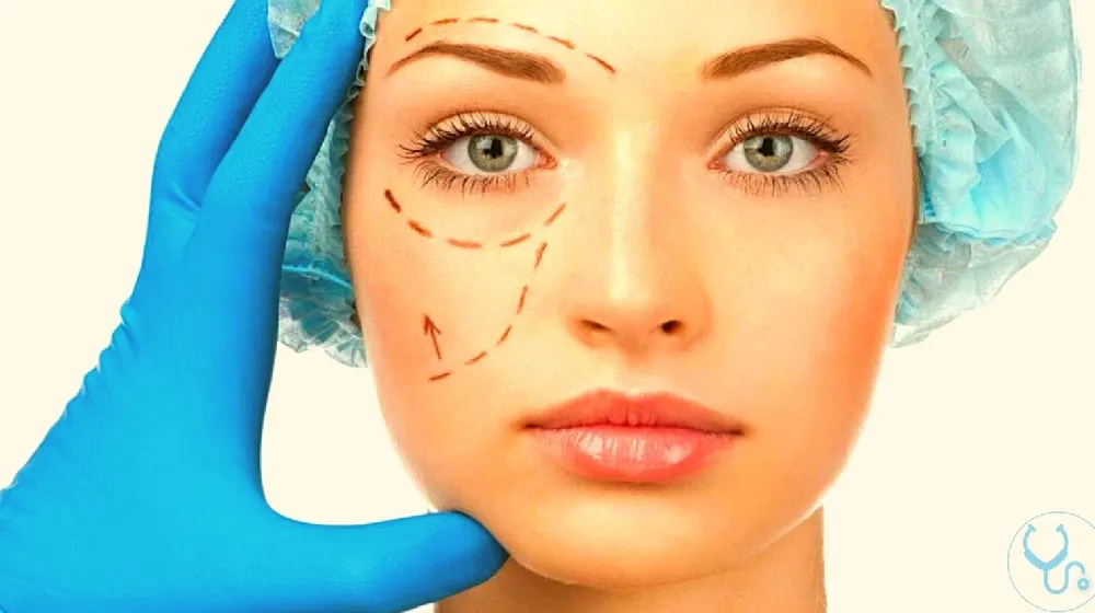 Transgender Facial Feminization Surgery